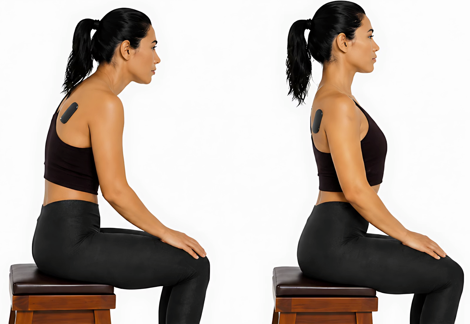 Before & after — shoulder